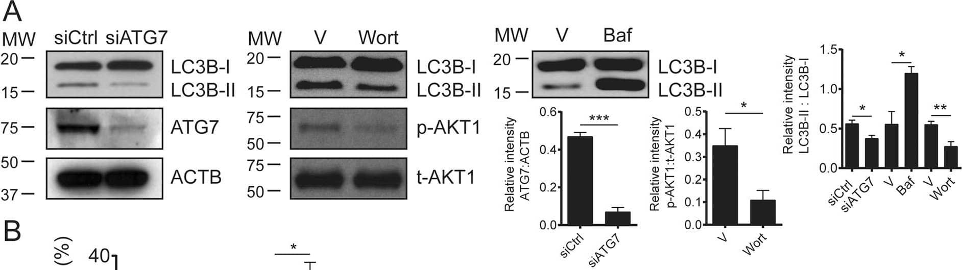 Western Blot: LC3B Antibody - BSA Free [NB600-1384] - Autophagy regulates the loading of LG3 on apoptotic exosome‐like vesicles (ApoExos).A Representative immunoblots & densitometric analysis of LC3, ATG7, phospho-AKT1, & total AKT1 from serum-starved (SS) HUVECs transfected with siCtrl or siATG7 or exposed to vehicle (V), wortmannin (100 nM; Wort), or bafilomycin A1 (20 nM, Baf).  beta -actin (ACTB) was used as a loading control. n = 3 for each condition. B HO/PI staining of apoptosis in SS HUVECs transfected with siCtrl or siATG7 or exposed to V, Baf, or Wort. n = 3–5 for each condition. ns (nonsignificant). C Immunoblots & densitometric analysis of cleaved caspase-3 in SS HUVECs transfected with siCtrl or siATG7 or exposed to V, Baf, or Wort.  beta -actin (ACTB) was used as a loading control. n = 3–5 for each condition. D Small particle flow cytometric quantifications of CMFDA+ AnnexinV+ ApoExos detected in the supernatant of HUVECs serum starved (SS) for 4 h & transfected with siCtrl or siATG7 or exposed to V, Baf, or Wort. n = 3 for each condition. E Representative immunoblots & densitometric analysis of LG3, 20S proteasome, LAMP2, & synthenin-1 in ApoExos purified from HUVECs serum starved (SS) for 4 h & transfected with siCtrl or siATG7 or exposed to V, Baf, or Wort. Ponceau red was used as a loading control. n = 3–5 for each condition. P values were obtained by the unpaired t test (*P < 0.05; **P < 0.01; ***P < 0.001). All values are expressed as the mean ± SEM. Image collected & cropped by CiteAb from the following publication (//pubmed.ncbi.nlm.nih.gov/35149669), licensed under a CC-BY license. Not internally tested by Novus Biologicals.