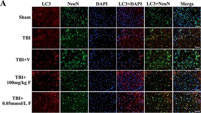 Immunocytochemistry/ Immunofluorescence: LC3B Antibody - BSA Free [NB600-1384] - Fucoxanthin activated autophagy after TBI.(A) Representative images of immunofluorescence for LC3 surrounding the injured cortex. LC3 punctate dots were observed in the cytoplasm by immunofluorescent staining of LC3 (red). Neuron cells & nuclei are labeled with NeuN (green) & DAPI (blue), respectively. Magnification: 40 x. Scale bar: 50 mm. (B) Mice brain tissues were collected 1 day after TBI in different groups, & the expression of LC3, Beclin-1 & p62 was measured by western blot. Fucoxanthin treatment significantly increased the level of LC3-II & Beclin-1 while decreasing the level of p62 after TBI. (C) 3-MA (400 nM) was injected i.c.v. 30 min before TBI. Mice were then subjected to TBI & treatment of fucoxanthin 30 min after TBI. Pretreatment with 3-MA significantly attenuated fucoxanthin-induced activation of autophagy & suppression of apoptosis & oxidative stress in the ipsilateral cortex. Data are presented as mean ± SEM, n = 6 per group; **p < 0.01, ***p < 0.001 versus sham group; #p < 0.05, ##p < 0.01 versus TBI + vehicle group; &&p < 0.01, &&&p < 0.001 versus TBI + fucoxanthin group.  beta -actin was used as a loading control. Image collected & cropped by CiteAb from the following publication (//pubmed.ncbi.nlm.nih.gov/28429775), licensed under a CC-BY license. Not internally tested by Novus Biologicals.