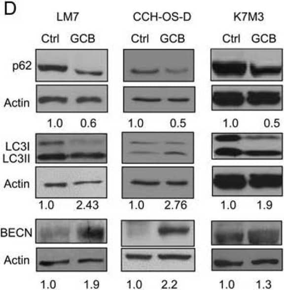 Western Blot: LC3B Antibody - BSA Free [NB600-1384] - Treatment with gemcitabine (GCB) induces autophagy in osteosarcoma cellsA. Following 48 hours of treatment with 1μM GCB, LM7, CCH-OS-D, & K7M3 cells were stained with the lysosomotropic agent acridine orange (1 μg/ml) for 15 minutes & then visualized under a confocal microscope. Treatment with GCB led to the formation of acidic vesicular organelles (AVOs –red/orange), as shown in the representative images. B. Flow cytometry was used to measure & quantify AVO formation in untreated (left) & treated (right) osteosarcoma cells. C. Cells were treated with 1μM GCB for 48 hours, & after fixation, cells were stained with anti-LC3 antibody & analyzed by fluorescence confocal microscopy. GCB increases the number of green punctae in the treated group as compared to the untreated. D. Expression of BECN, LC3, & p62 was analyzed using Western blot analysis. Cells were treated with GCB for 48 hours, lysed & extracted protein was analyzed using specific antibodies.  beta -actin was used as a loading control. Autophagy induction is demonstrated by an increase in the conversion of LC3I to LC3II, BECN expression & a decrease in p62 expression in the treated group as compared with the untreated. E. Treatment of OS cells with GCB (1μM, 48 hours), led to an increase in the formation of autophagic vacuoles (shown with red arrows) measured by transmission electron microscopy. Image collected & cropped by CiteAb from the following publication (//www.oncotarget.com/lookup/doi/10.18632/oncotarget.20308), licensed under a CC-BY license. Not internally tested by Novus Biologicals.