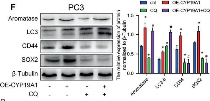 Western Blot: LC3B Antibody - BSA Free [NB600-1384] - The activated HeyL-aromatase axis promotes autophagic survival of PCSCs. (A) Gene signatures associated with autophagy-associated signaling pathways identified by GSEA in HeyLHigh samples vs. HeyLLow samples from the TCGA-PRAD dataset & in HeyL knockdown cells vs. ctrl cells. (B, C) Western blot analysis of Beclin1, LC3, & CD44 in LNCaP (B) & PC3 (C) cells after the indicated treatments. (D) Flow cytometry analysis of the CD44+/CD24− subpopulation in PC3 cells treated as indicated. (E, F) mRNA (E) & protein (F) levels of stemness-associated genes & LC3 in PC3 cells after the indicated treatment (one-way ANOVA). (G, H) mRNA & protein levels of stemness-associated genes & autophagy-related genes in PC3 cells treated with ICI182780 (G) & siER alpha  (H) (t-test). (I, J) Cleaved caspase3 levels in LNCaP & PC3 cells after the indicated treatments (one-way ANOVA). (K, L) Cleaved caspase3 levels in PC3 cells treated with ICI182780 (K) or transfected with siER alpha  (L) (t-test). Bic, bicalutamide; CQ, chloroquine. The data are presented as the mean ± SD values (n=3). *p < 0.05 vs. ctrl. #p < 0.05 vs. OE-HeyL, i_HeyL or OE-CYP19A1. Image collected & cropped by CiteAb from the following publication (//pubmed.ncbi.nlm.nih.gov/35096586), licensed under a CC-BY license. Not internally tested by Novus Biologicals.