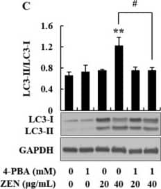 Western Blot: LC3B Antibody - BSA Free [NB600-1384] - 4-phenylbutyric acid (4-PBA) alleviated zearalenone (ZEN)-induced ER stress, autophagy, & downregulation of CYP3A4 & UGT1A. Before treatment with ZEN (20 & 40 μg/mL), cells were pretreated with 1 mM 4-PBA for 6 h. mRNA & protein expression were determined by quantitative real-time PCR (qRT-PCR) & Western blot analysis, respectively. (A) Cells were treated with ZEN for 24 h after pretreatment with 4-PBA & cell viability was measured by the trypan blue dye exclusion test. (B) Phosphorylation of eIF2 alpha  was evaluated in cells treated with ZEN for 2 h. The protein expression of (C) LC3-II/LC3-I & (D) CYP3A4 was determined in cells treated with ZEN for 24 h. (E) UGT1A mRNA levels were determined in cells treated with ZEN for 16 h. Data represent mean ± SEM of three independent experiments. * indicates significant difference vs. the control (* p < 0.05, ** p < 0.01, & *** p < 0.001). # indicates significant difference between groups (p < 0.05). Image collected & cropped by CiteAb from the following publication (//pubmed.ncbi.nlm.nih.gov/31861425), licensed under a CC-BY license. Not internally tested by Novus Biologicals.