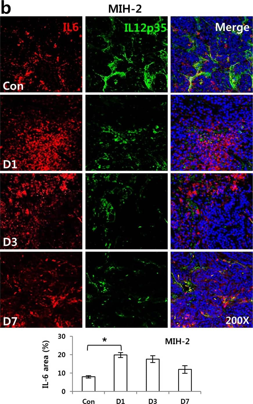 Immunocytochemistry/ Immunofluorescence: IL-12 Antibody [NB600-1443] - Irradiation-induced IL-6 suppressed IL-12 expression in tumors of hepatoma-bearing mice in vivo & DCs in vitro.IL-6 & IL-12 were measured at 1, 3, & 7 days after 10 Gy irradiation of tumors. Shown are the expressions of IL-6 & IL-12 in (a) HCa-1 & (b) MIH-2 tumors (* P < 0.05). BMDCs were prepared from bone marrow of mice & stimulated with LPS. (c) IL-6 expression analyzed at the indicated times by ELISA in irradiated or non-irradiated BMDCs in vitro. (d) IL-6R (** P < 0.01, vs No IR) & (e) sIL6R (** P < 0.01) were evaluated at 2 day after 10 Gy irradiation to BMDCs by FACS & ELISA, respectively. BMDCs were treated without or with IL-6 (20 ng/mL) plus LPS. (f) Down regulation of IL-12 production by IL-6 treatment in BMDCs (** P < 0.01). BMDCs were stimulated with LPS for activation & cultured with or without anti-IL-6 antibody (final concentration of 500 ng/mL) during the indicated times after irradiation in vitro. IL-6 & IL-12 were analyzed by ELISA. (g) Recovery of IL-12 production & (h) B7-1/ B7-2 expression using an anti-IL-6 antibody in irradiated-BMDCs stimulated with LPS in vitro. (** P < 0.01, * P < 0.05). Data are from three independent experiments. Image collected & cropped by CiteAb from the following publication (//pubmed.ncbi.nlm.nih.gov/26745884), licensed under a CC-BY license. Not internally tested by Novus Biologicals.