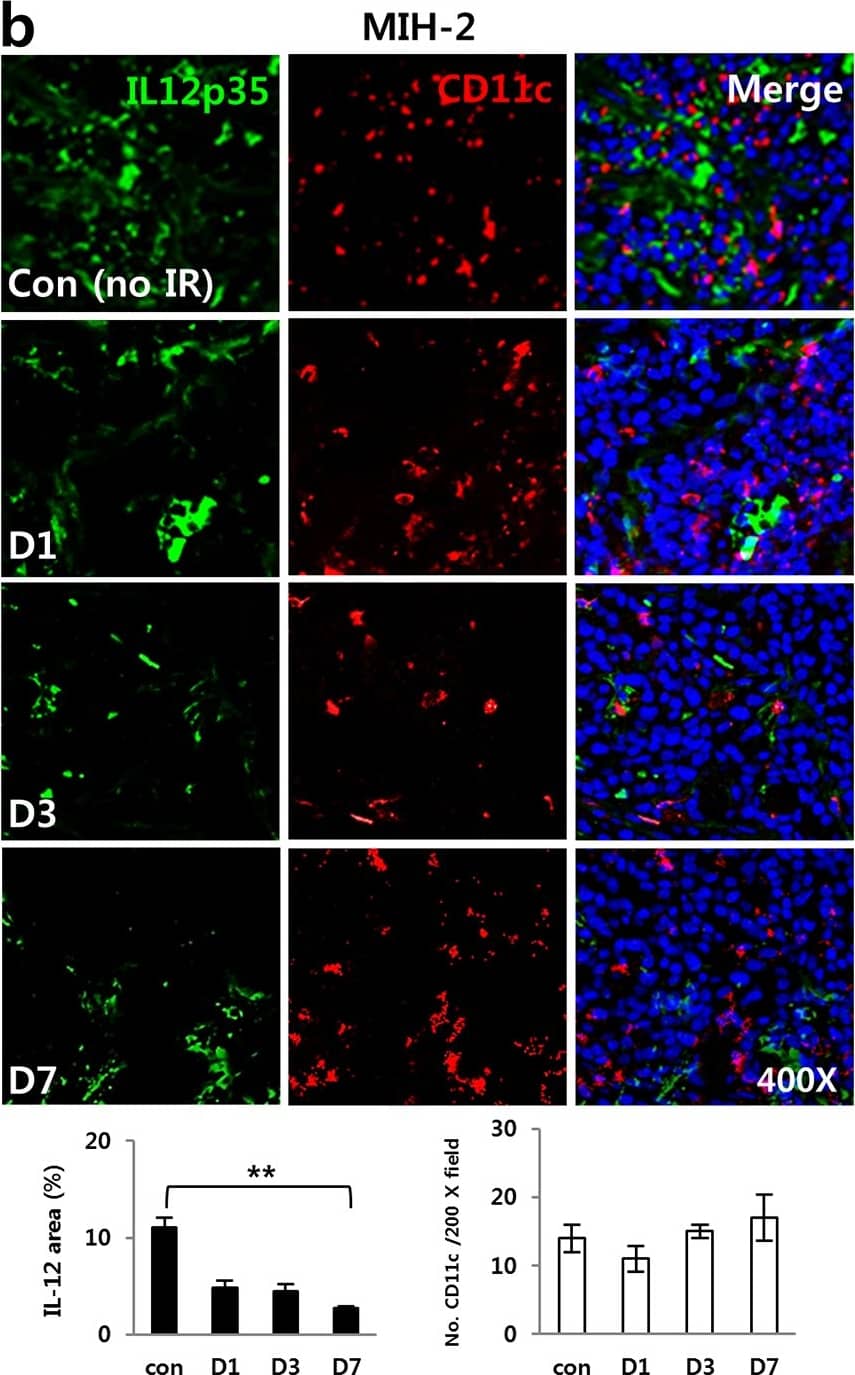 Immunocytochemistry/ Immunofluorescence: IL-12 Antibody [NB600-1443] - Irradiation inhibited IL-12 expression in tumors of hepatoma-bearing mice in vivo & DCs in vitro.HCa-1 & MIH-2 cells were injected intramuscularly into the right thighs of the mice, & tumors were irradiated with 10 Gy of radiation. Shown are IL-12 & DC (CD11c+) expressions at 1, 3, & 7 days after irradiation in (a) HCa-1 & (b) MIH-2 tumors & (c) IL-12 expression in the spleens of HCa-1 bearing mice (** P < 0.01). (d) IL-12 expression in BMDCs incubated with supernatant of MIH-2 tumor cells or supernatant of 10 Gy irradiating MIH-2 tumor cells. (** P < 0.01). DCs were differentiated from bone marrow of C3H/HeN normal mice (BMDCs). These were incubated for 72 h in supernatant of MIH-2 tumor cells with or without 10 Gy irradiation. IL-12 was intracellular stained with IL-12 antibody & analyzed by FACS. BMDCs also were stimulated with LPS (100 ng/mL) to allow maturation & irradiated with 10 Gy of radiation. (e) IL-12 expression (** P < 0.01), (f) cell viability, & (g) B7.1 expression in LPS stimulated BMDCs receiving 10 Gy radiation. (* P < 0.05). Data are from three independent experiments with five mice per group. Image collected & cropped by CiteAb from the following publication (//pubmed.ncbi.nlm.nih.gov/26745884), licensed under a CC-BY license. Not internally tested by Novus Biologicals.