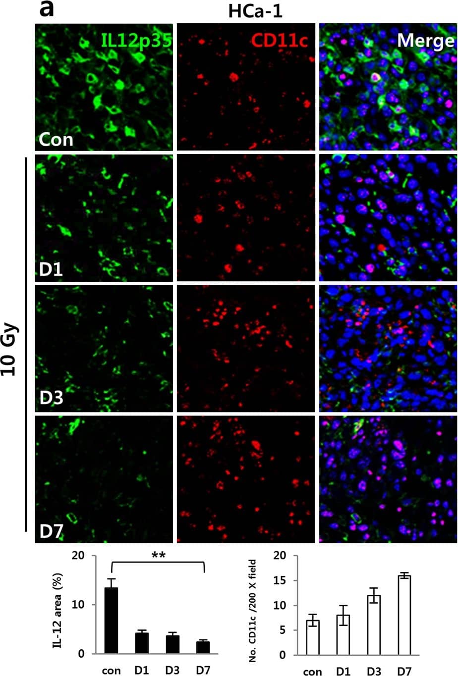 Immunocytochemistry/ Immunofluorescence: IL-12 Antibody [NB600-1443] - Irradiation inhibited IL-12 expression in tumors of hepatoma-bearing mice in vivo & DCs in vitro.HCa-1 & MIH-2 cells were injected intramuscularly into the right thighs of the mice, & tumors were irradiated with 10 Gy of radiation. Shown are IL-12 & DC (CD11c+) expressions at 1, 3, & 7 days after irradiation in (a) HCa-1 & (b) MIH-2 tumors & (c) IL-12 expression in the spleens of HCa-1 bearing mice (** P < 0.01). (d) IL-12 expression in BMDCs incubated with supernatant of MIH-2 tumor cells or supernatant of 10 Gy irradiating MIH-2 tumor cells. (** P < 0.01). DCs were differentiated from bone marrow of C3H/HeN normal mice (BMDCs). These were incubated for 72 h in supernatant of MIH-2 tumor cells with or without 10 Gy irradiation. IL-12 was intracellular stained with IL-12 antibody & analyzed by FACS. BMDCs also were stimulated with LPS (100 ng/mL) to allow maturation & irradiated with 10 Gy of radiation. (e) IL-12 expression (** P < 0.01), (f) cell viability, & (g) B7.1 expression in LPS stimulated BMDCs receiving 10 Gy radiation. (* P < 0.05). Data are from three independent experiments with five mice per group. Image collected & cropped by CiteAb from the following publication (//pubmed.ncbi.nlm.nih.gov/26745884), licensed under a CC-BY license. Not internally tested by Novus Biologicals.