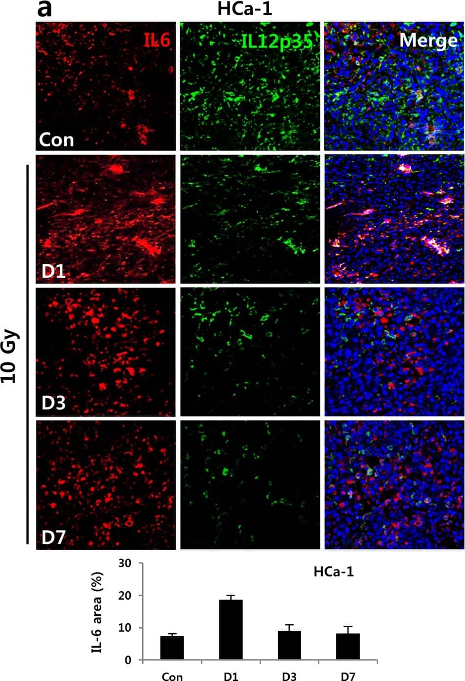 Immunocytochemistry/ Immunofluorescence: IL-12 Antibody [NB600-1443] - Irradiation-induced IL-6 suppressed IL-12 expression in tumors of hepatoma-bearing mice in vivo & DCs in vitro.IL-6 & IL-12 were measured at 1, 3, & 7 days after 10 Gy irradiation of tumors. Shown are the expressions of IL-6 & IL-12 in (a) HCa-1 & (b) MIH-2 tumors (* P < 0.05). BMDCs were prepared from bone marrow of mice & stimulated with LPS. (c) IL-6 expression analyzed at the indicated times by ELISA in irradiated or non-irradiated BMDCs in vitro. (d) IL-6R (** P < 0.01, vs No IR) & (e) sIL6R (** P < 0.01) were evaluated at 2 day after 10 Gy irradiation to BMDCs by FACS & ELISA, respectively. BMDCs were treated without or with IL-6 (20 ng/mL) plus LPS. (f) Down regulation of IL-12 production by IL-6 treatment in BMDCs (** P < 0.01). BMDCs were stimulated with LPS for activation & cultured with or without anti-IL-6 antibody (final concentration of 500 ng/mL) during the indicated times after irradiation in vitro. IL-6 & IL-12 were analyzed by ELISA. (g) Recovery of IL-12 production & (h) B7-1/ B7-2 expression using an anti-IL-6 antibody in irradiated-BMDCs stimulated with LPS in vitro. (** P < 0.01, * P < 0.05). Data are from three independent experiments. Image collected & cropped by CiteAb from the following publication (//pubmed.ncbi.nlm.nih.gov/26745884), licensed under a CC-BY license. Not internally tested by Novus Biologicals.