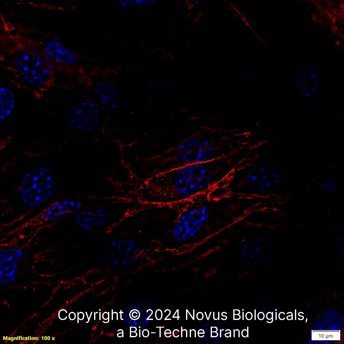 CD31/PECAM-1 (MEC13.3) was detected in immersion fixed MS1 mouse pancreas/Islet of Langerhans endothelial cell line using Rat anti-CD31/PECAM-1 (MEC13.3) Protein-G purified Monoclonal Antibody conjugated to DyLight 550 (Catalog # NB600-1475R) (red) at 2 µg/mL overnight at 4C. Cells were counterstained with DAPI (blue). Cells were imaged using a 100X objective and digitally deconvolved.    