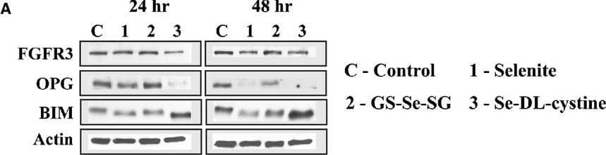 Western Blot: FGFR3 Antibody [NB600-1509] - (A) Western blot analysis of apoptotic markers following 24 & 48 hrs of selenite (5 μM), GS-Se-SG (5 μM) & Se-DL-cystine (100 μM) treatment. (B) Western blot analysis of autophagic & ER stress markers, evaluated after 1, 3, 6 & 18 hrs of treatment with selenite (5 μM), GS-Se-SG (5 μM) & Se-DL-cystine (100 μM). (C) Acridine orange staining of cells after 12 hrs of treatment with selenite (5 μM), GS-Se-SG (5 μM) & Se-DL-cystine (100 μM) (magnification 40 ×). (D) High-resolution transmission electron microscopy micrographs of control & 24 hrs Se-DL-cystine-treated cells, showing the presence of autophagosome, as evident from double-layered membrane structure with inclusion bodies. (E) Western blot detection of ubiquitinylated proteins after treatments with different selenium compounds (similar doses as previous) for 6 hrs. Five microgram cell lysate was loaded into each lane. The lane intensity was analysed by using Adobe Photoshop program (version CS5).  beta -actin was used as a loading control (Fig. 4A & B). C: Control; 1: selenite; 2: GS-Se-SG; 3: Se-DL-cystine. Image collected & cropped by CiteAb from the following publication (//pubmed.ncbi.nlm.nih.gov/24400844), licensed under a CC-BY license. Not internally tested by Novus Biologicals.