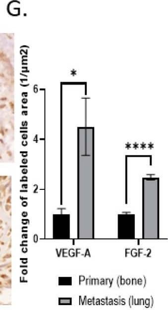 High VEGF-A and FGF2 labeling levels in an orthotopic OS mouse model and in human lung metastasis specimens: (A) U2-OS tumor image at 5 weeks and (B) anti-VEGF-A immunolabeling. Representative images of primary OS tumors in mice and nearby bone. The labeling pattern was mainly cytoplasmic; however, nuclear labeling was also noticed. Images were obtained under a ×40 magnification. Scale bar denotes 50 um. (C) Quantitative analysis of immunolabeled area (tumor/bone ratio) of primary OS tumors in mice normalized to nearby bone. Primary OS tumors exhibit significantly higher VEGF-A levels compared to control bone; *** p < 0.001. (D) FGF2 immunolabeling. Representative images of primary OS tumors in mice and nearby bone. Images were obtained under ×40 magnification. Scale bar denotes 50 um. (E) Quantitative analysis of immunolabeled area (tumor/bone ratio) of primary OS tumors in mice normalized to nearby bone. Primary OS tumors exhibit significantly higher FGF2 levels compared to control bone; ** p < 0.01. (F) Representative anti-VEGF-A and anti-FGF2 immunolabeling of human metastatic OS and non-metastatic OS patient specimens. Images showing nuclear labeling pattern. Microscope images were obtained under ×40 magnification. Scale bar denotes 50 um. (G) Quantitative analysis of immunolabeled area (1/um2) in metastatic vs. non-metastatic human OS specimens. Higher levels of VEGF-A (primary, N = 7; metastasis, N = 8) and FGF2 (primary, N = 6; metastasis, N = 14) were obtained in metastatic samples compared to primary tumors; * p < 0.05, and **** p < 0.0001. Image collected and cropped by CiteAb from the following open publication (//www.mdpi.com/2072-6694/15/6/1818), licensed under a CC-BY license. Not internally tested by Novus Biologicals.