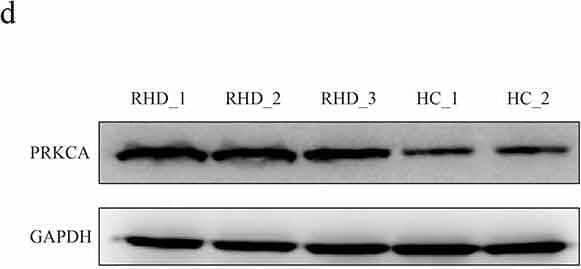 DNA methylation of PRKCA in mitral valve of RHD. (a) the overview of CpG loci distribution within human PRKCA gene. (b) DNA methylation on 5ʹ terminal of PRKCA (promoter, first exon and first intron) in mitral valve of RHD by MeDIP-qPCR assay. (c) PRKCA transcription levels in mitral valve of RHD by qPCR assay. (d) PRKCA protein levels in mitral valve of RHD by WB assay. (e) PRKCA protein levels calculated by gray intensity analysis. (f) the correlation between DNA methylation and PRKCA transcription by pearson correlation analysis. the given data was processed as mean +/- standard error and compared between RHD and HC groups by student’s t-test. ‘RHD’: rheumatic heart disease; ‘HC’: healthy control; ‘FC’: fold change Image collected and cropped by CiteAb from the following open publication (//pubmed.ncbi.nlm.nih.gov/34482802), licensed under a CC-BY license. Not internally tested by Novus Biologicals.