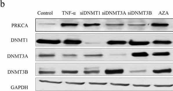 The effect of DNMTs on DNA methylation of PRKCA in human cardiomyocyte cells. (a) the mRNA and (b) protein of PRKCA in AC16 cells induced by TNF-alpha , DNMTs RNA interference and 5-azacytidine. (c) the mRNA and (d) protein of PRKCA in RL-14 cells induced by TNF-alpha , DNMTs RNA interference and 5-azacytidine. DNA methylation on 5ʹ terminal of PRKCA (promoter, first exon and first intron) in (e) AC16 and (f) RL-14 cells induced by TNF-alpha , DNMTs RNA interference and 5-azacytidine. the given data from triplicate experiments was processed as mean +/- standard error and compared by student’s t-test. No. 1 to 6 indicate six comparison with control group. ‘FC’: fold change; ‘si’: siRNA; ‘AZA’: 5-azacytidine Image collected and cropped by CiteAb from the following open publication (//pubmed.ncbi.nlm.nih.gov/34482802), licensed under a CC-BY license. Not internally tested by Novus Biologicals.