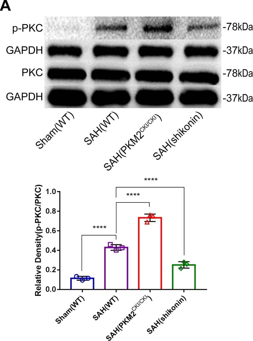 Expression of proteins downstream of PKM2 after SAH. A–D Western blotting and quantitative analysis of p-PKC, PKC, p-ERK and ERK. The following four kinds of mice were used for the in vivo study: WT sham mice and WT mice 24 h after SAH; PKM2CKI/CKI and Aldh1| 1-creERT2 mice 24 h after SAH; and WT mice 24 h after SAH. The cell grouping method was the same as that described in Sect. 3.6 (n = 3 per group); one-way ANOVA, *P < 0.05; **P < 0.01; ***P < 0.001; ****P < 0.0001 Image collected and cropped by CiteAb from the following open publication (//fluidsbarrierscns.biomedcentral.com/articles/10.1186/s12987-024-00550-8), licensed under a CC-BY license. Not internally tested by Novus Biologicals.