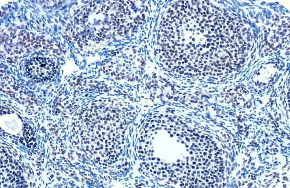 Immunohistochemistry-Paraffin: E2F-1 Antibody (18E10) [NB600-209] - E2F-1 antibody [18E10] detects E2F-1 protein at nucleus by immunohistochemical analysis.Sample: Paraffin-embedded mouse ovary.E2F-1 stained by E2F-1 antibody [18E10] (NB600-209) diluted at 1:200.Antigen Retrieval: Citrate buffer, pH 6.0, 15 min