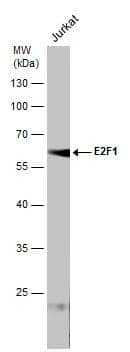 Whole cell extract (30 ?g) was separated by 10% SDS-PAGE, and the membrane was blotted with E2F-1 antibody [16G7] (NB600-210) diluted at 1:1000. The signal was developed with Trident ECL plus-Enhanced. 
