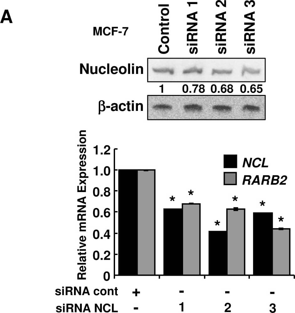 Reduction of COUP-TFII or nucleolin decreases RAR beta 2 transcription in MCF-7 cells.MCF-7 (A) and T47D (B) cells were transfected with control siRNA or an siRNA targeting nucleolin for 48 h. T47D cells were treated with EtOH or 1 uM atRA for 24 h. Q-PCR for nucleolin (NCL) and RARB2. Values are the average of triplicates. C, Western blot showing COUP-TFII and RAR beta 2 expression after transfection with siCOUP-TFII. Values are relative to  beta -actin. MCF-7 were transfected with siControl or siCOUP-TFII for 48 h and treated with 1 uM atRA for 6 h. Q-PCR was also performed for RRIG1. P<0.001 * versus control or ** versus atRA. Image collected and cropped by CiteAb from the following open publication (//pubmed.ncbi.nlm.nih.gov/22693611), licensed under a CC-BY license. Not internally tested by Novus Biologicals.