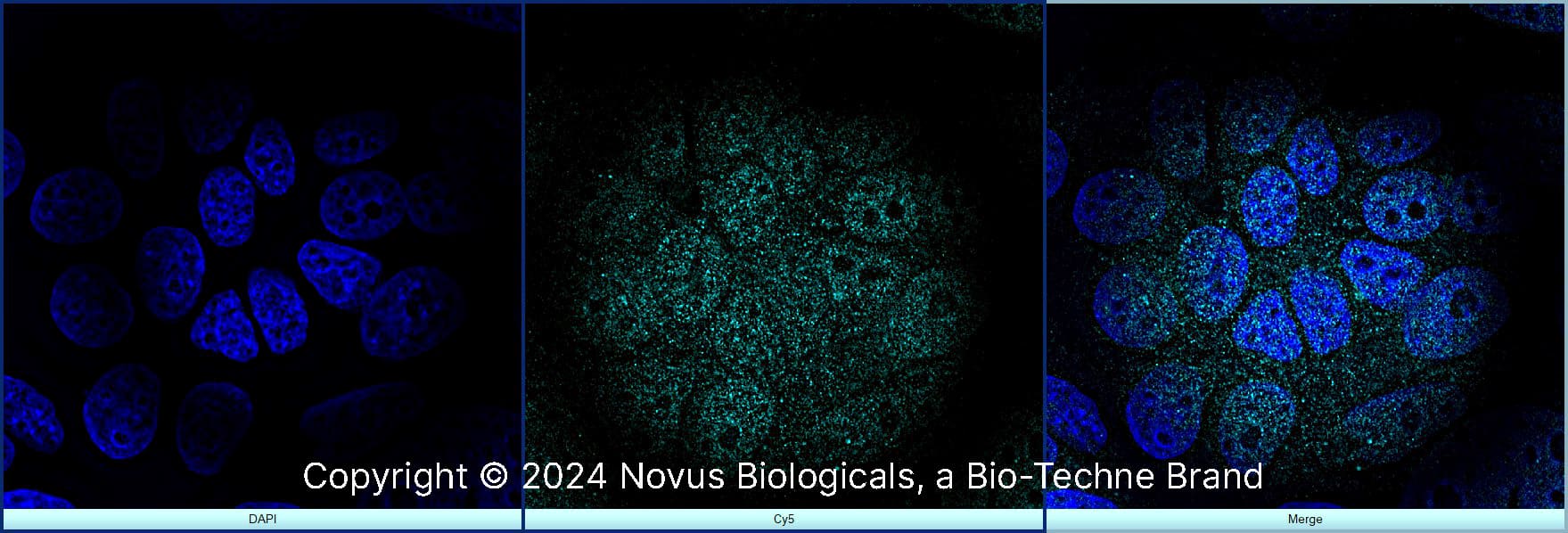 FoxP3 was detected in immersion fixed MCF7 human breast cancer cell line using Rabbit anti-FoxP3 Affinity Purified Polyclonal Antibody conjugated to Alexa Fluor® 647 (Catalog # NB600-245AF647) (light blue) at 10 µg/mL overnight at 4C. Cells were stained counterstained with DAPI (blue). Cells were imaged using a 100X objective and digitally deconvolved.