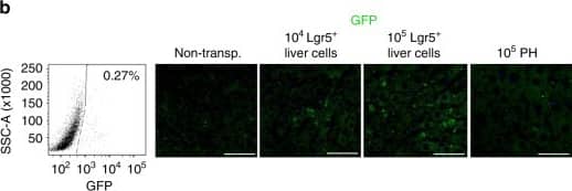 Immunocytochemistry/ Immunofluorescence: GFP Antibody [NB600-303] - Lgr5+ liver stem cells transplantation decreased liver fibrosis. a Schematic overview of the experimental setup. Eight-week-old wild-type C57 mice were i.p. injected with CCL4 (2 ml/kg, Sigma-Aldrich) dissolved in olive oil at a ratio of 1:4, or olive oil alone (2 ml/kg) twice a week for 6 weeks. Lgr5-GFP+ liver stem cells or primary hepatocyte (PH) derived from Lgr5-GFP mice were transplanted into the liver fibrosis mice by intrasplenical injection on day 0. b Lgr5+ cells were isolated from Lgr5-GFP mice treated with CCL4 by FACS assay for transplantation (left). The liver Lgr5 expression was stained using anti-GFP antibody in mice with Lgr5+ cells or PH transplantation (right) on day 40. n = 10 mice, scale bars, 200 μm. c, d Lgr5+ liver stem cells transplantation decreased CCL4-induced liver fibrosis & recovered liver functions. Lgr5-GFP+ liver stem cells or PH transplantation were described in a; the livers were harvested & stained using H&E & Sirius Red for fibrosis analysis & quantification of positive-staining areas measured by Image J software (c). The serum was harvested for ALT & AST analysis (d, e). For c, scale bars, 200 μm, the results are shown as mean ± s.d. of five independent sections taken randomly per mice & a total of 50 tissue specimens in each group (n = 10 mice) *p < 0.05, **p < 0.01. For d, e, triplicates for each condition were analyzed. The results are shown as mean ± s.d. of three independent experiments. *p < 0.05, **p < 0.01 Image collected & cropped by CiteAb from the following publication (//pubmed.ncbi.nlm.nih.gov/29079780), licensed under a CC-BY license. Not internally tested by Novus Biologicals.