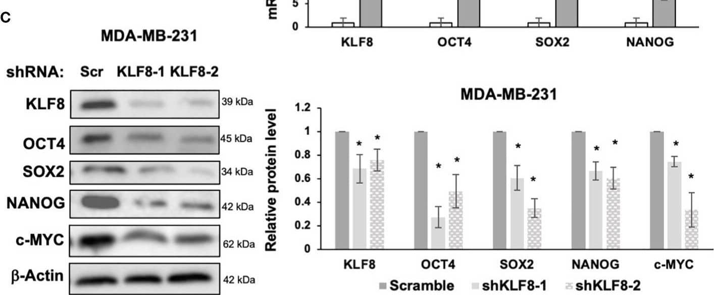 KLF8 regulates expression of stem cell markers in breast cancer cells. (A) Lysates from MDA-MB-231 cells stably overexpressing control or KLF8 were collected for immunoblot analysis of CSCs markers using indicated antibodies (left), and quantified graph of relative level of CSCs detected by immunoblot from MDA-MB-231 cells control or with KLF8 overexpression (right). (B) Quantified graph showing relative mRNA level of CSCs markers as detected by qRT-PCR using probes against genes in MDA-MB-231 cells stably overexpressing control or KLF8. (C) Lysates from MDA-MB-231 cells stably expressing control or KLF8 shRNA were collected for immunoblot analysis of CSCs markers using indicated antibodies (left), and quantified graph of relative level of CSCs levels (right). (D) Quantified graph showing relative mRNA level of CSCs markers as detected by qRT-PCR using probes against indicated targets in MDA-MB-231 cells stably expressing control or KLF8 shRNA. Student t test reported as mean +/- SEM, *p<0.05. Image collected and cropped by CiteAb from the following open publication (//pubmed.ncbi.nlm.nih.gov/37152043), licensed under a CC-BY license. Not internally tested by Novus Biologicals.