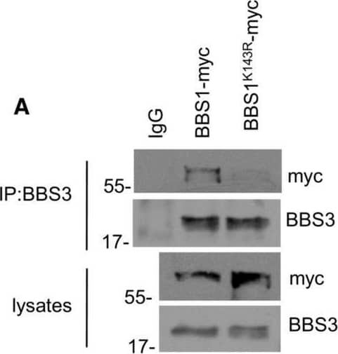 Dynamic modeling of hBBSome and Ub‐hBBSome complexACo‐immunoprecipitation assay of BBS1 or BBS1K143R and BBS3 from lysates of HEK293 transiently expressing the indicated transgenes.BCumulative data of the experiments shown in (A). The data are expressed as mean +/- SD of three independent experiments. Student's t test, ***P < 0.001.CFull atomistic description of the homology model of the octameric complex of the BBSome human sequence (hBBSome) in the Arl6GTP‐bound (open) conformation, with the monoubiquitylation at K143 of hBBS14 alpha  (Ub‐hBBSome).DFocus on the full atomistic model of hBBSome core complex components (BBS1, BBS4, BBS8, BBS9, and BBS18).ETop view of the interaction details between BBS18  alpha ‐helix and the BBS18 U‐bolt domains with the BBS8TPR and the superhelix of BBS4TPR, respectively.FTop view of the interaction details between BBS18  alpha ‐helix with the BBS1GAE domain and the superhelix of BBS4TPR.GSurface representation of the CG‐MD model of the Ub‐hBBSome, representing the starting point of the CG‐MD simulation. Residues involved in the Arl6GTP‐bound binding mode are highlighted in dark green.H, ISurface representation of the last CG‐MD frame of the wt‐hBBSome and the Ub‐hBBSome, respectively showing the progressive closure of Arl6‐binding site located between BBS1 beta prop and BBS7 beta prop. Residues involved in the Arl6GTP‐bound binding mode are highlighted in red and yellow, respectively. Image collected and cropped by CiteAb from the following open publication (//pubmed.ncbi.nlm.nih.gov/36744302), licensed under a CC-BY license. Not internally tested by Novus Biologicals.