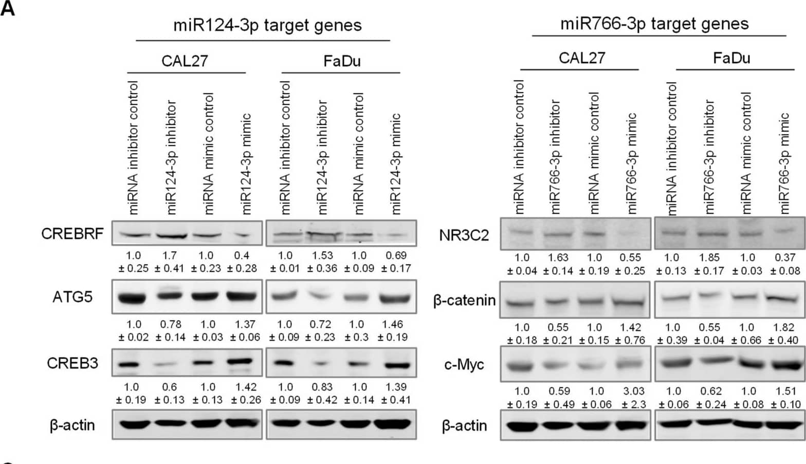 The role of miR124-3p and miR766-3p target genes in HNSCC drug resistance. (A) Expression analysis of miR124-3p and miR766-3p direct target genes and downstream target genes by Western blot in HNSCC cell lines (CAL27 and FaDu), with or without transfection with miRNA inhibitors or miRNA mimics. Left: Western blotting showed the expression of miR124-3p target gene (CREBRF) and CREBRF target genes (ATG5 and CREB3). Right: Western blotting showed the expression of miR766-3p target gene (NR3C2) and NR3C2 target genes ( beta -catenin and c-Myc). Quantitative data (relative expression levels after  beta -actin-corrected) from three independent experiments are disclosed below each protein band. Data represent the mean +/- SD (n = 3). (B) Target gene analysis in sensitive (CAL27) vs. resistant (CAL27/FP-R) HNSCC cell lines. Quantitative data (relative expression levels after  beta -actin-corrected) is shown below each protein band. (C) The effect of NR3C2 and/or CREBRF knockdown on drug-induced cytotoxicity in CAL27 and FaDu. Cells were transfected by 10 nM siRNA (single or combined) for 24 h followed by 72 h exposure to the indicated drug. Cytotoxicity was determined by MTT assay. IC50 values are listed in Table S7. (D) Measurement of apoptosis in CAL27 or FaDu cells in response to cisplatin or 5-FU +/- 24 h prior transfection with 10 nM siRNA. After 24 h of drug treatments, cells were labeled with anti-annexin V-FITC antibody and PI and then analyzed with flow cytometry. A two-way ANOVA with Bonferroni’s correction for multiple comparisons was used to analyze group comparisons, and data are presented as means +/- SD (n = 3). * p < 0.05, *** p < 0.001 (vs. control siRNA), and ### p < 0.001 (vs. untreated). Image collected and cropped by CiteAb from the following open publication (//pubmed.ncbi.nlm.nih.gov/36358691), licensed under a CC-BY license. Not internally tested by Novus Biologicals.