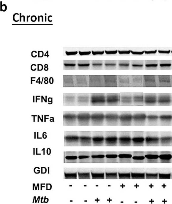 MFD alters immune signaling in adipose tissue during (a) acute and (b) chronic Mtb infection. Immunoblot analysis of immune cells (CD4, CD8, and F4/80) and inflammatory markers (IFN gamma , TNF alpha , IL-6, and IL-10) in the WAT lysates of RD-fed and MFD-fed uninfected and infected C57BL/6 mice during acute infection (30 DPI) and chronic (3 months) post-infection is shown. The error bars represent standard error of the mean. * p < 0.05, ** p < 0.01, and *** p < 0.001 between indicated groups. Image collected and cropped by CiteAb from the following open publication (//pubmed.ncbi.nlm.nih.gov/36676177), licensed under a CC-BY license. Not internally tested by Novus Biologicals.
