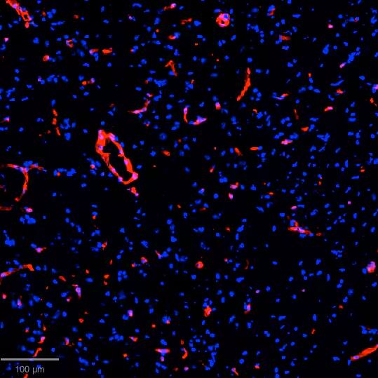 Immunohistochemistry-Frozen: Collagen I Antibody [Alexa Fluor® 532] [NB600-408AF532] - Cryopreserved murine brain tissue stained with Collagen I Antibody [Alexa Fluor® 647] (Catalog # NB600-408AF647) (red) and Hoechst (blue). Image from a verified customer review.