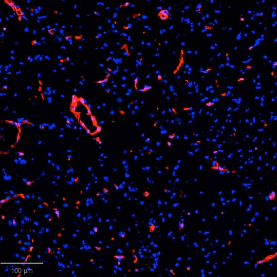 Immunohistochemistry-Frozen: Collagen I Antibody [Alexa Fluor® 594] [NB600-408AF594] - Cryopreserved murine brain tissue stained with Collagen I Antibody [Alexa Fluor® 647] (Catalog # NB600-408AF647) (red) and Hoechst (blue). Image from a verified customer review.