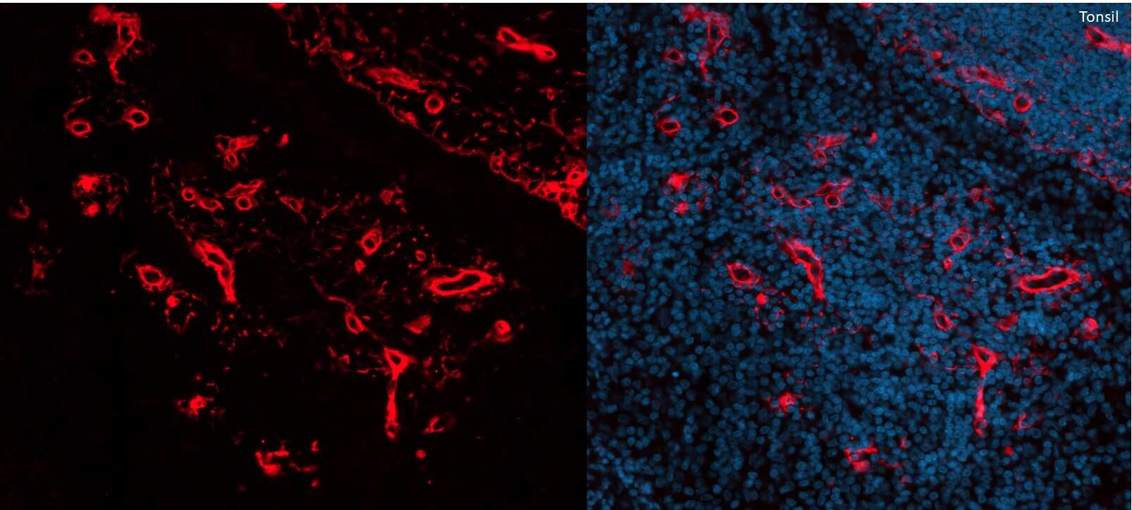 Immunohistochemistry-Paraffin: Rabbit Polyclonal Collagen I Antibody [Alexa Fluor® 750] [NB600-408AF750] - Collagen I was stained in human FFPE tissue. Primary antibody dilution: 1/1000 in blocking buffer. HIER antigen retrieval at pH 9 for 20min. Image from a verified customer review.