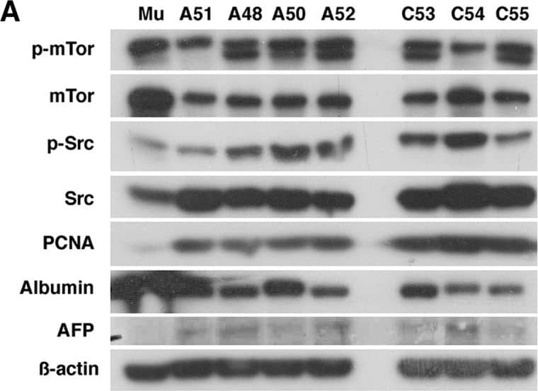 Western Blot: Albumin Antibody - BSA Free [NB600-41532] - Primary cell characterization.As per the materials & methods, tumors were isolated from mice & cultured. A, Primary murine hepatocytes were used as controls (Mu). Western blot revealed the primary cultures of APN KO A51, A48, A50 & A52 & WT C53, C54 & C55 cells to express p-mTOR, mTOR, p-Src, Src, PCNA, albumin & AFP. B, Immunofluorescence for K8 & pan-cytokeratin (PK) confirmed that A52 cells were epithelial (Scale bar 20 μM). C, Table showing in vitro & in vivo growth characteristics of WT & APN KO primary cultures. Scale of growth (+ to ++++). Image collected & cropped by CiteAb from the following publication (//pubmed.ncbi.nlm.nih.gov/30794695), licensed under a CC-BY license. Not internally tested by Novus Biologicals.