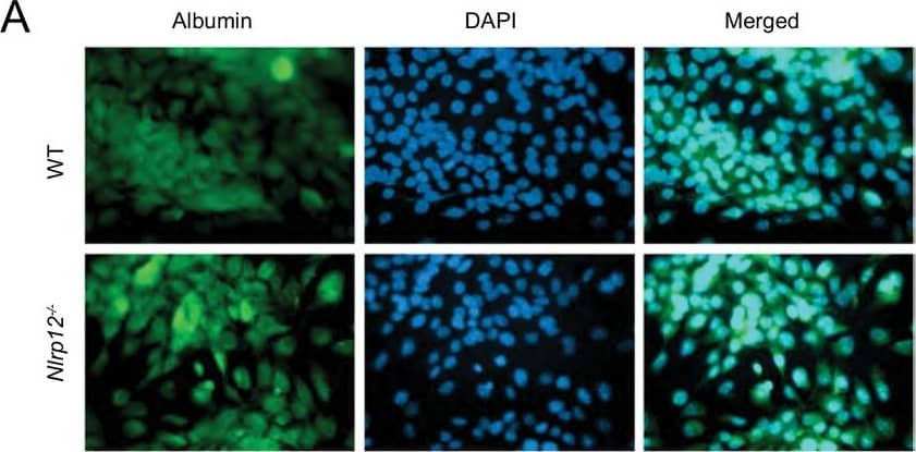 NLRP12 downregulates multiple JNK activating pathways in hepatocytes.(A) For checking the purity of primary hepatocytes, hepatocytes isolated from healthy WT and Nlrp12-/- mouse livers were immunostained with antibody for hepatocyte-specific marker Albumin and counterstained with DAPI. (B) Primary hepatocytes from WT and Nlrp12-/- healthy mouse livers were cultured and stimulated with LPS (1 μg/mL), PGN (10 μg/mL), TNF alpha  (20 ng/mL), and IL-6 (20 ng/mL) for 4 hr. The expression of indicated genes was analyzed by real-time qPCR. Data represent means +/- SD (n = 3) and representative of three independent experiments. *p<0.05. **p<0.01, ***p<0.001. Statistical difference was determined by two-tailed unpaired t-test. (C) HepG2 cells stably expressing either GFP or NLRP12 were stimulated with LPS (1 μg/mL), PGN (10 μg/mL), TNF alpha  (20 ng/mL), and IL-6 (20 ng/mL) for 4 hr, and the expression of indicated genes was analyzed by real-time qPCR. Data represent means +/- SD (n = 3) and representative of three independent experiments. *p<0.05. **p<0.01, ***p<0.001. Statistical difference was determined by two-tailed unpaired t-test. (D) Nlrp12-/- primary hepatocytes were stimulated with LPS in the presences or absence of JNK inhibitor. The levels of cMyc, P-cJun, and P-JNK were measured by Western blotting. (E) NLRP12 was knocked down in HepG2 cells using CRISPR/Cas9 technology. Cells were then stimulated with LPS (1 ug/ml) and the activation of JNK was measured by Western blotting.10.7554/eLife.40396.024Figure 6—figure supplement 1—source data 1.NLRP12 downregulates inflammatory responses in hepatocytes in responses to multiple stimuli.NLRP12 downregulates inflammatory responses in hepatocytes in responses to multiple stimuli. Image collected and cropped by CiteAb from the following open publication (//pubmed.ncbi.nlm.nih.gov/30990169), licensed under a CC-BY license. Not internally tested by Novus Biologicals.