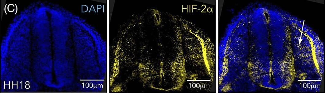 Hypoxia inducible factor (HIF)‐2 alpha  is expressed in trunk neural crest cells. A,C, Immunostaining of HIF‐2 alpha  in sections from trunk axial level of wild‐type chick embryos at HH11, A, HH13, B, and HH18, C. Arrow denotes ventrally migrating HIF‐2 alpha  positive cells. D, Co‐immunostaining of HIF‐2 alpha  and HNK1 (marker of migrating neural crest) in sections from trunk axial level of wild‐type HH18 chick embryos. Arrows denote migrating cells double positive for the two proteins. E, Sections of HH13 wild‐type embryo immunostained with DAPI for visualization of nuclei and secondary antibody only (donkey anti‐rabbit Alexa Fluor‐546). F, Western blot analysis for detection of HIF‐2 alpha  protein at 21% and 1% O2 following siRNA mediated knockdown of HIF‐1 alpha  or HIF‐2 alpha . DIP treated cells were used as a positive control and SDHA as loading control. Lanes between 21% and 1% siCTRL were removed from this figure, indicated by the black line. G, Immunohistochemical staining for HIF‐2 alpha  in sections of SK‐N‐BE(2)c neuroblastoma cells cultured at 21% or 1% O2. H, Schematic of where oxygen measurements were performed. I, Oxygen saturation in the trunk of chick embryos during development measured ex ovo using microsensor technique. Error bars represent SEM, n ≥ 3 biologically independent replicates for each time point Image collected and cropped by CiteAb from the following open publication (//pubmed.ncbi.nlm.nih.gov/32940375), licensed under a CC-BY license. Not internally tested by Novus Biologicals.