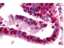  Affinity Purified anti-Ubiquitin Activating Enzyme antibody was used at a 10 ug/ml to detect UBE1 in a variety of tissues including adrenal, breast, colon (epithelium), kidney, liver, lung (respiratory epithelium), ovary (oocyte and endothelium), pancreas (islet and exocrine), placenta, prostate (epithelium), skin (epithelium), spleen (lymphocytes), stomach (chief), testis, thymus, tonsil, and uterus (glandular, stroma). In many cells a punctate nuclear staining was observed. Other cells showed both cytoplasmic and nuclear staining. This image shows UBE1 staining of human lung tissue. Tissue was formalin-fixed and paraffin embedded. Personal Communication, Tina Roush, LifeSpan Biosciences, Seattle, WA.