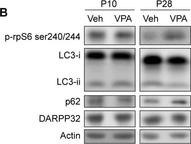 VPA reduces autophagy at P28. (A) Schematic of VPA administration. (B) Representative Western blot images for LC3B, p62, p-rpS6 S240/244, DARPP32, & actin. (B–G) Quantification of (B–D) p-rpS6 S240/244 relative to actin, (B,E,F) LC3B-ii relative to actin (B,G,H) p62 & (B,I,J) DARPP32 normalized to VPA untreated (veh, vehicle) mice at P10 & P28, respectively. Data analyzed with unpaired, two-tailed t-test; (C) p-rpS6 S240/244/actin at P10, ns; (D) p-rpS6 S240/244/actin at P28, t11 = 2.882, p = 0.0149 (E) LC3B-ii/actin at P10, ns; (F) LC3B-ii/actin at P28, t10 = 2.231, p = 0.047; (G) p62 at P10, ns; (H) p62 at P28, t10 = 3.752, p = 0.0038; (I) DARPP32 at P10, ns, & (J) DARPP32 at P10, ns, *p < 0.05, **p < 0.01, ns not significant, n = 4–7 mice/treatment. Image collected & cropped by CiteAb from the following publication (//pubmed.ncbi.nlm.nih.gov/32296308), licensed under a CC-BY license. Not internally tested by Novus Biologicals.