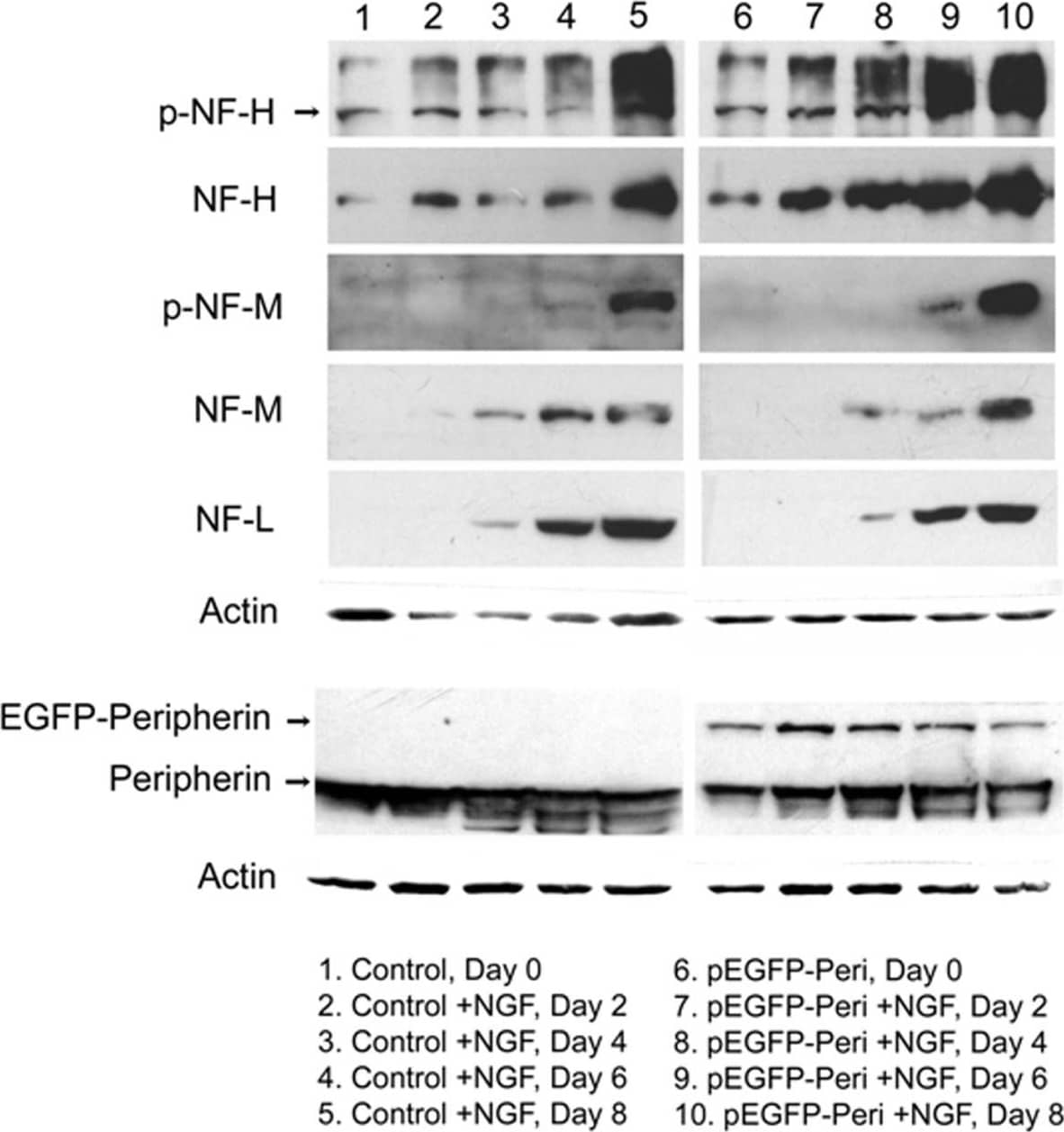 Western Blot: beta-Actin Antibody (AC-15) [NB600-501] - Western blot analysis of neurofilament proteins. Protein levels of NF-H, phosphorylated NF-H, NF-M & phosphorylated NF-M are enhanced in pEGFP-Peripherin cells, especially at 8 days of NGF induction. However, protein level of NF-L is not influenced in pEGFP-Peripherin cells. The EGFP-Peripherin fusion protein is constantly expressed in pEGFP-Peripherin cells, while not in PC12 cells. The protein level of endogenous peripherin is similar between control PC12 cells & pEGFP-Peripherin cells. Image collected & cropped by CiteAb from the following publication (//jbiomedsci.biomedcentral.com/articles/10.1186/1423-0127-19-8), licensed under a CC-BY license. Not internally tested by Novus Biologicals.