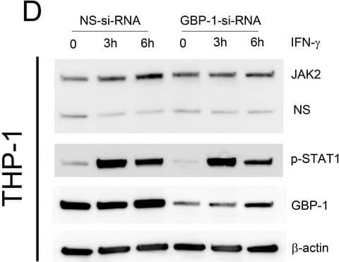 Western Blot: beta-Actin Antibody (AC-15) [NB600-501] - (A) Protein expression level of CCL2 with WARS silencing under control & IFN gamma  stimulation conditions, performed on human primary PBMC-derived macrophages. *p<0.05, Student’s t-test(B) Western blot analysis showing the protein levels of phosphorylation of STAT1 with WARS silencing under control & IFN gamma  stimulation conditions, performed on human primary PBMC-derived macrophages. (C) Relative mRNA & protein expression levels for CCL2, TNF alpha , STAT1, JAK2 & CD36 with GBP1 silencing under control & IFN gamma  stimulation conditions, performed on THP-1-differentiated macrophage-like cells. (D) Western blot analysis showing the protein levels of JAK2 & phospho-STAT1 with GBP1 silencing in THP-1 macrophage-like cells at 3 & 6 hr after IFN gamma  stimulation. Image collected & cropped by CiteAb from the following publication (//pubmed.ncbi.nlm.nih.gov/30303482), licensed under a CC-BY license. Not internally tested by Novus Biologicals.