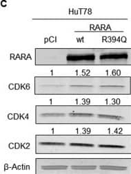 Western Blot: beta-Actin Antibody (AC-15) [NB600-501] - RARA drives expression of cyclin-dependent kinases(A) Knockdown of RARA causes G1 cell cycle arrest (P = 0.004) in Mac-1 cells. (B) Expression of the regulators of cell cycle progression, CDK6, CDK4, & to a lesser extent, CDK2, is inhibited by RARA knockdown in Mac-1 cells. (C) Expression of CDK6, CDK4, & CDK2 is increased following overexpression of RARAwt & RARAR394Q in HuT78 cells. RARA, retinoic acid receptor alpha; wt, wild-type; siRNA, small interfering RNA; CDK, cyclin-dependent kinase. Image collected & cropped by CiteAb from the following publication (//www.oncotarget.com/lookup/doi/10.18632/oncotarget.15441), licensed under a CC-BY license. Not internally tested by Novus Biologicals.