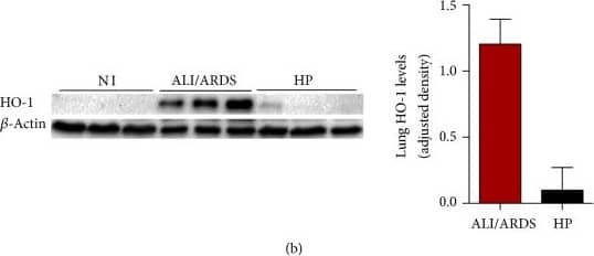 Western Blot: beta-Actin Antibody (AC-15) [NB600-501] - The expression of HO-1 is higher in ALI/ARDS-developing mice compared to HP-developing mice. (a) Representative images of lung sections subject to immunohistochemistry for detection of HO-1 protein (brown), counterstained with hematoxylin. The graph represents the quantification of protein expression of HO-1 by immunohistochemistry on the 7th day after infection (DAI). Dashed line represents the average of values from noninfected mice. (Mann–Whitney test, n = 10, ∗∗p ≤ 0.01). (b) Immunoblot of HO-1 & beta actin control (left). Protein levels of HO-1 measured by immunoblot densitometry (right). Values are expressed in HO-1 band densities adjusted by the beta actin control. (c) Expression of HO-1 mRNA levels in lungs of ALI/ARDS-developing mice & HP-developing mice (unpaired t-test, n = 28, ∗p ≤ 0.05). (d) Values of HO-1 in lung cell lysates of ALI/ARDS versus HP-developing mice (Mann–Whitney test, n = 8, ∗p ≤ 0.05). (e) Protein levels of HO-1 in the serum of ALI/ARDS-developing mice & HP-developing mice (Mann–Whitney test, n = 9, ∗p ≤ 0.05). (f) Bilirubin levels in the serum of ALI/ARDS & HP infected mice. Bilirubin levels are significantly higher in ALI/ARDS than in noninfected mice (one-way ANOVA with Bonferroni's multiple comparison test n = 38, #p ≤ 0.05). The dashed lines represent the average values of noninfected mice (minimum n = 3). In graphs ((b) & (e)) the values of noninfected mice were equal or less than 0. In graphs with fold increase, the values of ALI/ARDS-developing & HP-developing mice are compared to the average values of noninfected mice. Image collected & cropped by CiteAb from the following publication (//pubmed.ncbi.nlm.nih.gov/27974865), licensed under a CC-BY license. Not internally tested by Novus Biologicals.