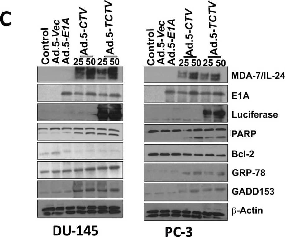 Western Blot: beta-Actin Antibody (AC-15) [NB600-501] - Ad.5-TCTV induces ER stress & apoptosis in cancer cells. (A) Breast cancer cells (MDA-MB-231 & SUM-159) treated with 25 pfu of Ad.5-E1A or the indicated pfu of Ad.5-CTV or Ad.5-TCTV for 72 h. Cells were then collected & Western blotting analysis was performed for signaling molecules using specific antibodies &  beta -actin served as a loading control. (B) Breast cancer cells were cultured in 8-well chamber slides & infected with 25 pfu of Ad.5-E1A, Ad.5-CTV, or Ad.5-TCTV for 72 h. Cells were fixed & TUNEL assays were performed. Data presented as TUNEL positive cells in a defined microscopic field as compared with un-treated control cells. (C) Prostate cancer cells (DU-145 & PC-3) were treated as described in A, cells were then collected & Western blotting analysis was performed for signaling molecules using specific antibodies &  beta -actin served as a loading control. (D) Prostate cancer cells were treated as described in B & cells were fixed & TUNEL assays were performed. Data presented as TUNEL positive cells in a defined microscopic field as compared with un-treated control cells. Scale bar: 200 μM. Image collected & cropped by CiteAb from the following publication (//pubmed.ncbi.nlm.nih.gov/33670594), licensed under a CC-BY license. Not internally tested by Novus Biologicals.