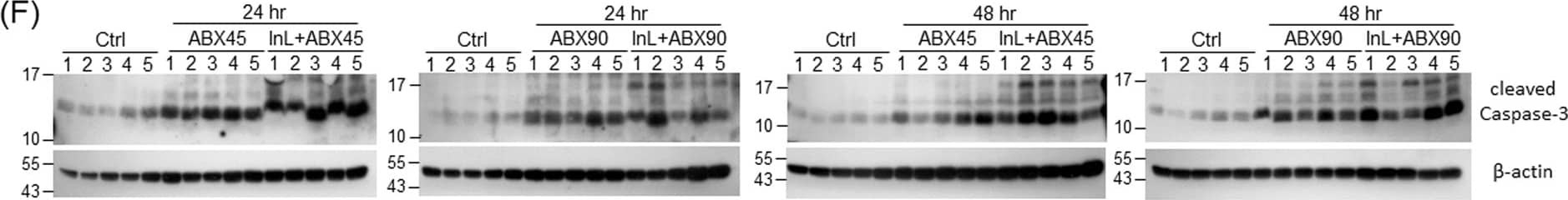 Western Blot: beta-Actin Antibody (AC-15) [NB600-501] - Intralipid enhances the biodistribution of paclitaxel in mice organs. (A–E) Determination by LC/MS of biodistribution of paclitaxel in mice organs at 24 or 48 hrs after Abraxane treatment. The organs include liver (A), lung (B), kidney (C), spleen (D), & heart (E). The number above the box denotes the median amount of remaining paclitaxel in mice organs. n.d., not determined. (F) Western blot analysis of the apoptosis signal of the cleaved caspase-3 in the liver at 24 & 48 hrs after treatment with 45 or 90 mg/kg Abraxane with or without Intralipid. The blots of caspase-3 &  beta -actin are cropped from different parts of the same gel. (G) The intensities of the apoptosis signals normalized with  beta -actin are quantified, & the values summarized in the right box-and-whisker plot, denote the relative intensities compared with those in the control group. (H) Immunohistochemistry of the cleaved caspase-3 in liver sections. Immunohistochemistry was performed on liver tissues in each group, & one case is shown. Original: 200x magnification; Inserts: 400 magnification. Image collected & cropped by CiteAb from the following publication (//pubmed.ncbi.nlm.nih.gov/32071352), licensed under a CC-BY license. Not internally tested by Novus Biologicals.