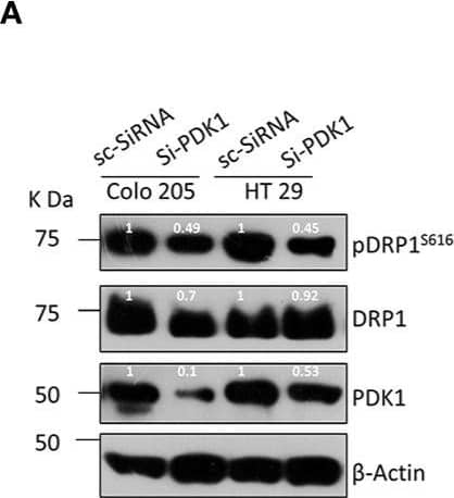 Western Blot: beta-Actin Antibody (AC-15) [NB600-501] - Pyruvate dehydrogenase kinase 1 (PDK 1) regulates DRP1 mediated mitochondrial fission & glycolytic phenotype in BRAFV600E cells. (A, B) Western blot & representative confocal micrographs (2.5x zoom, 60x original magnification) of si-PDK1 silenced BRAFV600E CRC cells, showing a reduction in both pDRP1S616 levels as well as mitochondrial fission after PDK1 knockdown, 30-40 cells were quantified (n=3, mean± SEM), red= mitochondria, CMX Ros stained & blue= Nuclei, DAPI stained, statistical analysis was done by two way ANOVA, followed by Bonferroni post-tests comparing replicate means by column with corresponding p values shown. (C, D) Genetic & pharmacologic knockdown of PDK1 in BRAFV600E CRC cells leads to a reduction in cell proliferation (n= 4, mean± SEM) & clonogenic rates in soft agar (n=3, mean± SEM) respectively; statistical analysis for proliferation was done by 2-way ANOVA followed by Bonferroni post-tests comparing replicate means by row with corresponding p values shown, & statistical analysis for soft agar clonogenic assay was done by unpaired t-test followed by Welch’s correction assuming unequal variance in means, corresponding p values shown. Image collected & cropped by CiteAb from the following publication (//pubmed.ncbi.nlm.nih.gov/33738242), licensed under a CC-BY license. Not internally tested by Novus Biologicals.