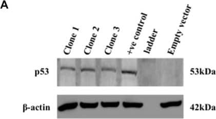Western Blot: beta-Actin Antibody (AC-15) [NB600-501] - Cell death & DNA damage in response to treatment in A549/p53 dominant-negative cells(A) Confirmation of stable clones was done by western blot analysis using p53 specific antibody. (B) MTT assay for cisplatin shows that the mutant cell line is resistant to the drug as compared p54-wt A549 cells. (C) Confocal images of A549/p53 dominant negative cells shows an elevated level of DNA damage in combination than single agent treatment. Increased accumulation of  gamma -H2AX indicates DNA damage. Nucleus= Blue (DAPI), F-actin= Red (TRITC),  gamma -H2AX= Green (FITC). (D) Western blot analysis shows a caspase mediated cell death in A549/p53 mut cells in response to treatment. (E) AnnexinV-PI dual staining & flow cytometry analysis shows significantly higher apoptosis in combination treatment than low dose cisplatin & scriptaid. Q1=necrotic population, Q2=late phase apoptosis, Q3=live cells, Q4= early phase apoptosis. C= control, L=2μg/ml cisplatin, S1= 1μg/ml scriptaid. * indicates p < 0.05. Image collected & cropped by CiteAb from the following publication (//www.oncotarget.com/lookup/doi/10.18632/oncotarget.12378), licensed under a CC-BY license. Not internally tested by Novus Biologicals.