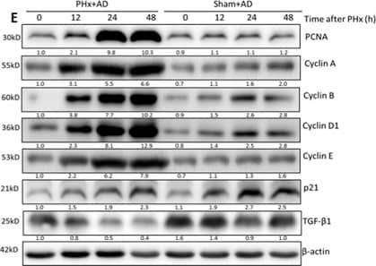 Western Blot: beta-Actin Antibody (AC-15) [NB600-501] - Amiodarone enhanced liver growth & hepatocyte proliferation in the liver regeneration after PHx.Wild-type mice were intraperitoneally injected with vehicle (Veh), amiodarone (AD), or chloroquine (CQ) at 0.5 h before PHx or sham operation & then once per day until 168 h. Liver tissues were harvested at 0–168 h after surgery. Liver-to-body-weight ratios were calculated (A). Liver sections at 24 h after the sham operation, PHx with Veh, AD, or CQ were stained with H&E; original magnification, 400X (B). Representative immunohistochemical staining of Ki67 is shown (C). The percentage of Ki67-positive nuclei in hepatocyte was counted under low-power fields (200 ×) in 15 random sections from at least six different mice (D). Liver tissues were harvested at 0 h, 12 h, 24 h, or 48 h after surgery, & the tissue extracts were analyzed for PCNA, cyclin A, B, D1, E, p21, TGF-beta 1, &  beta -actin protein by Western blotting (E,F). The values are shown as the mean ± SD in the bar graph & compared by Student’s t test. #P < 0.05 versus vehicle-treated PHx. Scale bar, 25 μm in B, 50 μm in C (n = 6). Image collected & cropped by CiteAb from the following publication (//www.nature.com/articles/srep15807), licensed under a CC-BY license. Not internally tested by Novus Biologicals.