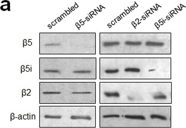 Western Blot: beta-Actin Antibody (AC-15) [NB600-501] - (a) Immunoblots of proteasome catalytic subunits in H727 cells transfected with siRNA targeting  beta 5,  beta 2 or  beta 5i. (b) The catalytic activity of  beta 5 subunit was decreased in H727 cells transfected with siRNA targeting  beta 5 compared with H727 cells transfected with scrambled siRNA. (c) Effects of siRNA knockdown of  beta 5,  beta 5i, or  beta 2 on Cfz sensitivity (IC50 values) in H23 & H727 cells. Data are shown as mean ± SD derived from a single non-linear regression based on n = 3 replicates per compound per concentration. (d) Heat map showing proteasome catalytic subunit activity profiles of 6 PI-naïve patient MM samples purchased from Conversant Biologics & AllCells (left). The numbers represent hydrolysis rates of respective substrates (RFU/min, mean values derived from three technical replicates) & were converted to color format & clustered by using the program “R” (//www.R-project.org) (left panel). Carfilzomib (Cfz) cell viability of the same 6 patient MM cells was measured via CellTiter-Glo Luminescent Cell Viability Assay (right panel). Image collected & cropped by CiteAb from the following publication (//pubmed.ncbi.nlm.nih.gov/30858500), licensed under a CC-BY license. Not internally tested by Novus Biologicals.