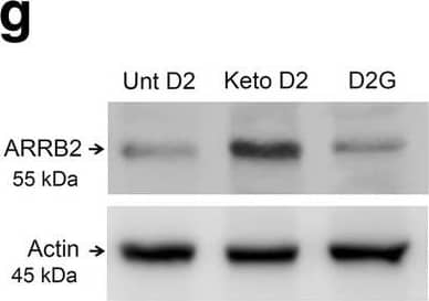 Western Blot: beta-Actin Antibody (AC-15) [NB600-501] - Analysis of NLRP3, IL-1 beta , & ARRB2 expression in untreated (Unt) & Keto D2 & D2G retina & ON. a, bNlrp3 (a), *p = 0.0219, & Il-1 beta  (b), *p = 0.0151 mRNA levels normalized to Hprt mRNA levels determined by qRT-PCR; n = 8 samples per group. c Western blot analysis of NLRP3 & IL-1 beta  protein levels in the retina. d, e Quantification by densitometry of NLRP3 (d), ***p = 0.0001, ***p = 0.0001, & mature IL-1 beta  (e), ***p = 0.0001, ***p = 0.0001 protein levels normalized to  beta -actin levels; n = 3 blots per group, each with independent samples. f IL-1 beta  protein levels in the ON analyzed by ELISA, **p = 0.0092; n = 8 samples per group. g Western blot analysis of ARRB2 protein levels in the retina. h Quantification by densitometry of ARRB2 protein normalized to  beta -actin; n = 3 blots per group, each with independent samples. i Capillary tube electrophoresis of ARRB2 protein levels in the optic nerve normalized to  beta -actin ***p = 0.0001, ***p = 0.0001; n = 3 ON per group. All bar graphs are presented as the mean ± SEM, n = 5–9, analyzed by two-tailed unpaired t test Image collected & cropped by CiteAb from the following publication (//pubmed.ncbi.nlm.nih.gov/30424795), licensed under a CC-BY license. Not internally tested by Novus Biologicals.