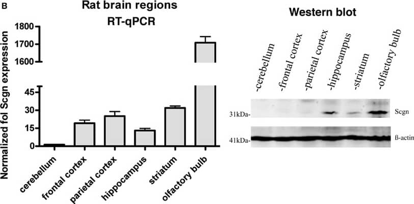 Western Blot: beta-Actin Antibody (AC-15) [NB600-501] - Expression of Secretagogin in different regions of human & rat brain. Tissues from different brain areas were analyzed for relative Secretagogin gene & protein expression by RT-qPCR & Western blotting. (A) Human post-mortem tissues from three individuals were analyzed with regard to the following specific brain regions: cerebellum, frontal cortex, parietal cortex, hippocampus, thalamus, & olfactory bulb. Western blot analysis was performed from tissue of white matter, thalamus, hypothalamus, hippocampus, stem ganglia, cerebellum, frontal cortex, parietal cortex, & occipital cortex. Equal protein loading was verified by staining with  beta -actin antibody. (B) Rat brain tissues from three adult rats were dissected & analyzed from cerebellum, frontal cortex, parietal cortex, hippocampus, striatum, & olfactory bulb. A representative Western blot of equal amounts of protein from cerebellum, frontal cortex, parietal cortex, hippocampus, striatum, & olfactory bulb is shown on the right.  beta -actin immunostaining was again used as loading control. Image collected & cropped by CiteAb from the following publication (//journal.frontiersin.org/article/10.3389/fnmol.2012.00084/abstract), licensed under a CC-BY license. Not internally tested by Novus Biologicals.