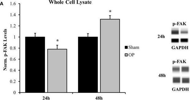 Western Blot: GAPDH Antibody (6C5cc) [NB600-502] - Western blot analysis for whole cell & nuclear signal transduction proteins. (A) Phosphorylated FAK (Y397) was significantly decreased at 24 h & significantly increased at 48 h as compared to sham. (B) Nuclear localization of corresponding signal transduction molecules, p38, & p65, were decreased at 24 h & increased at 48 h as compared to sham. *p < 0.05, #p = 0.056, Data are represented as mean ± SEM, whole cell: n = 9–10/group; nuclear: n = 7–9/group. Image collected & cropped by CiteAb from the following publication (//pubmed.ncbi.nlm.nih.gov/30853931), licensed under a CC-BY license. Not internally tested by Novus Biologicals.