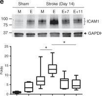 Western Blot: GAPDH Antibody (6C5cc) [DyLight 680] [NB600-502FR] - Effective targeting of EcoHIV diminishes post-ischemic stroke inflammation. Mice were infected, treated with ART-7 & ART-11, & subjected to ischemic stroke as in Fig. 6b, c. mRNA levels of cellular activation markers Iba1 (a) & GFAP (b) 7 days post stroke. Protein expression levels of Iba1 (c), GFAP (d), & ICAM1 (e) were quantified by immunoblotting in sham & ischemic stroke animals at day 14 post-stroke in mock (M) & EcoHIV-infected (E) mice that were treated with ART-7 (E + 7) or ART-11 (E + 11). Representative blots are shown, & quantified results are illustrated on the bar graphs. mRNA levels of anti-inflammatory markers ICAM-5 (f) & FoxP3 (g), & tissue degrading enzymes MMP2 (h) & MMP9 (i) were quantified by RT-qPCR. Impact of therapy on viral DNA genome levels was evaluated in ipsilateral hemisphere (j) & spleen (k); n = 5–16 mice per group, 2 independent experiments. Whiskers-box plots represent centerline median, with interquartile range & min-max whiskers. Other graphs represent data as mean & SEM with individual data points. Source data are provided as a Source Data file. *p < 0.05 or **p < 0.01; one-way ANOVA, followed by Tukey multiple comparison test (a, b & f–k), & unpaired t test (c–e) Image collected & cropped by CiteAb from the following publication (//pubmed.ncbi.nlm.nih.gov/31043599), licensed under a CC-BY license. Not internally tested by Novus Biologicals.