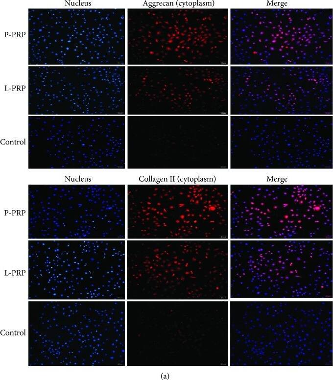 P-PRP induces more extracellular matrix-related proteins. (a) Collagen II and aggrecan in the cytoplasm of the coculture cells imaged by fluorescence microscopy. (b) Production of collagen II and aggrecan, as measured by western blot. Image collected and cropped by CiteAb from the following open publication (//pubmed.ncbi.nlm.nih.gov/30425747), licensed under a CC-BY license. Not internally tested by Novus Biologicals.