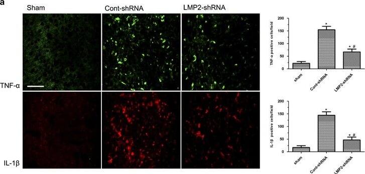 LMP2 knockdown by shRNA reduced the expression of TNF-alpha  and IL-1 beta  after MCAO. (a) Immunofluorescence labeling revealed that both TNF-alpha  and IL-1 beta  immunoreactivity was significantly upregulated in the ipsilateral ischemic hemisphere compared with sham-operated animals. In contrast, LMP2 knockdown by shRNA significantly reduced the expression of TNF-alpha  and IL-1 beta  (A). Five rats in each group were used for immunofluorescent assays (n=5). (b) Western blot confirmed that TNF-alpha  and IL-1 beta  protein levels were reduced to 37.4 and 44.8% compared with the Cont-shRNA group, respectively (*P<0.001, compared with the sham-operated controls; #P<0.001 compared with the cont-shRNA group). Scale bars=50 μm. Five rats in each group were used for western blot (n=5) Image collected and cropped by CiteAb from the following open publication (//pubmed.ncbi.nlm.nih.gov/25633295), licensed under a CC-BY license. Not internally tested by Novus Biologicals.