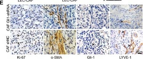 Immunohistochemistry-Paraffin: GLI-1 Antibody - BSA Free [NB600-600] - Inhibition of Hh signaling in CAFs blocks its effects on lymphangiogenesis in vivo & in vitro(A) Representative images & statistical analyses of migration of LECs in a co-culture invasion system with CAFs stably transfected with shNC or Gli-shRNA lentivirus in the presence of rSHH (1 μg/ml). (B) Representative images & statistical analyses of capillary tube formation of LECs treated with supernatants from cultures of CAFs stably transfected with shNC or Gli-shRNA lentivirus in the presence of rSHH (1 μg/ml). (C) Bright field images & graphical representation of the weights of tumours of subcutaneous tumours from mice (n=5) bearing Caov3 SHH-OE cells co-injected with CAFs stably transfected with shNC or Gli-shRNA lentivirus 20 days after tumour implantation. (D) Growth properties of subcutaneous tumours in mice derived from Caov3 SHH-OE cells co-injected with CAFs stably transfected with shNC or Gli-shRNA lentivirus. Kaplan-Meier plot of time to tumour progression, as evidenced by survival rates over time. (E) IHC staining for Ki-67,  alpha -SMA, Gli-1 & LYVE1 in tumour sections from mice in the two groups. (F) Graphical representation of the number of LYVE1+ vessels counted from IHC images in panel E. (**P<0.01, ***P<0.001). Image collected & cropped by CiteAb from the following publication (//www.oncotarget.com/lookup/doi/10.18632/oncotarget.18621), licensed under a CC-BY license. Not internally tested by Novus Biologicals.