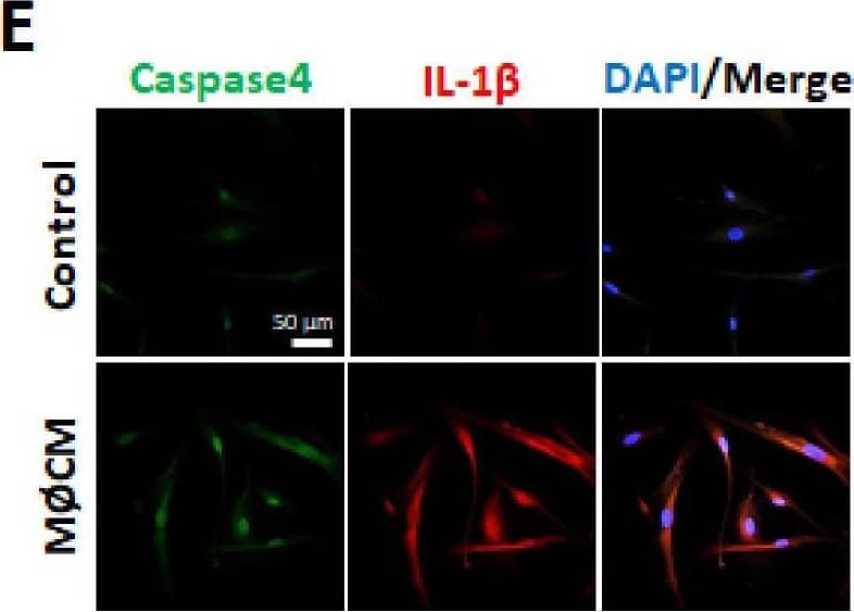 Expression of pyroptosis-related genes is increased by M1 macrophage conditioned media in ASCs. hASCs were incubated with M1-like macrophage-CM (MØCM) for 24 h. (A) mRNA and (B,C) protein expression levels were measured by qRT-PCR and western blotting, respectively. #p < 0.05 vs. Control, ** p < 0.01 vs. Control, * p < 0.001 vs. Control. (D) Caspase-1 and GSDMD and (E) Caspase-4 and IL-1 beta  expression levels were detected by immunofluorescence. Blue indicates the nuclei. Scale bar = 50 um. Image collected and cropped by CiteAb from the following open publication (//pubmed.ncbi.nlm.nih.gov/34360711), licensed under a CC-BY license. Not internally tested by Novus Biologicals.